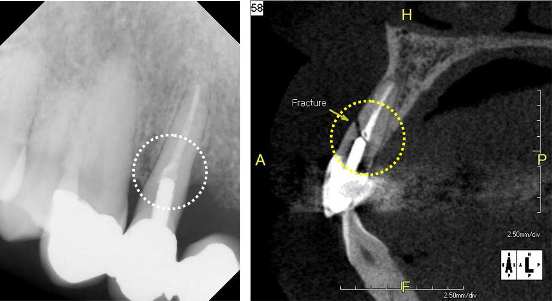 Radiografii 3D CRANEX3D